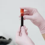 Introduction to Blood: Plasma, Buffy Coat, and Hematocrit