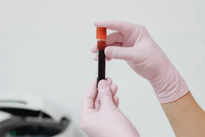 Introduction to Blood: Plasma, Buffy Coat, and Hematocrit