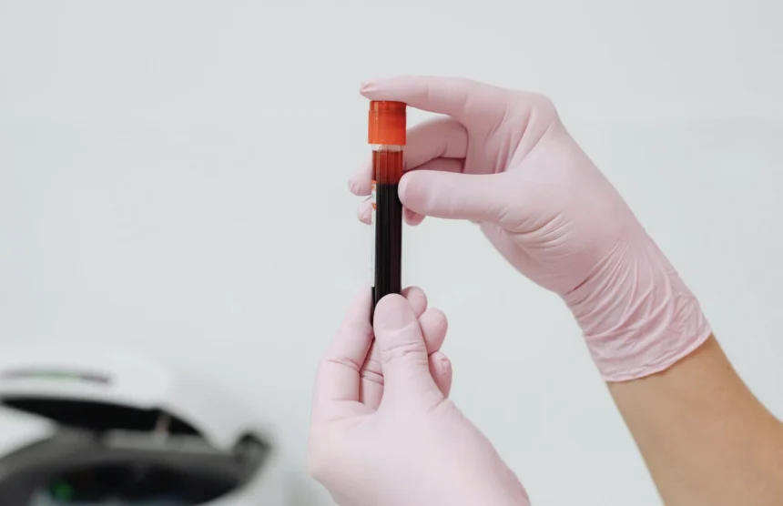 Introduction to Blood: Plasma, Buffy Coat, and Hematocrit