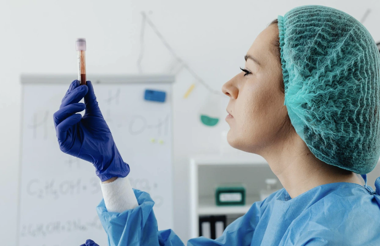 RDW Blood Test results sample