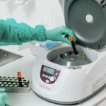 What RDW Means in a Blood Test